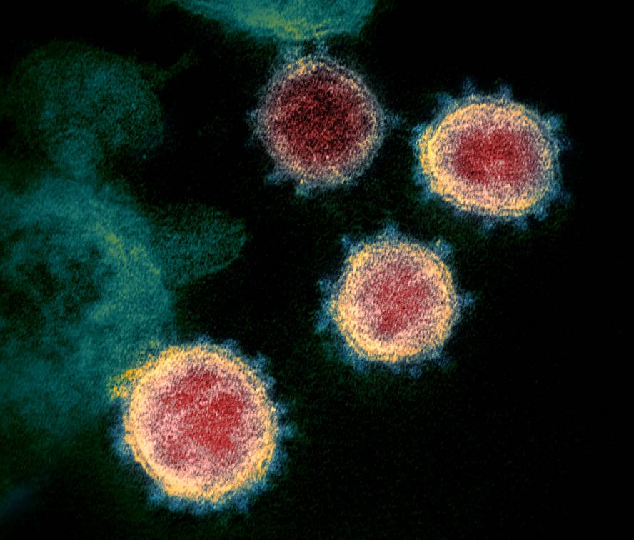 sars-cov-2aren-transmisio-bideak-gero-eta-ezagunag