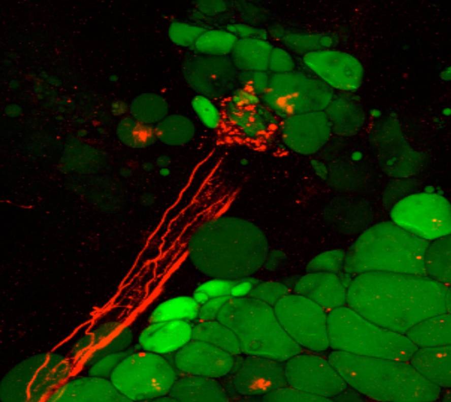 gantza-desegiten-duen-mekanismo-neuronal-bat-aurki